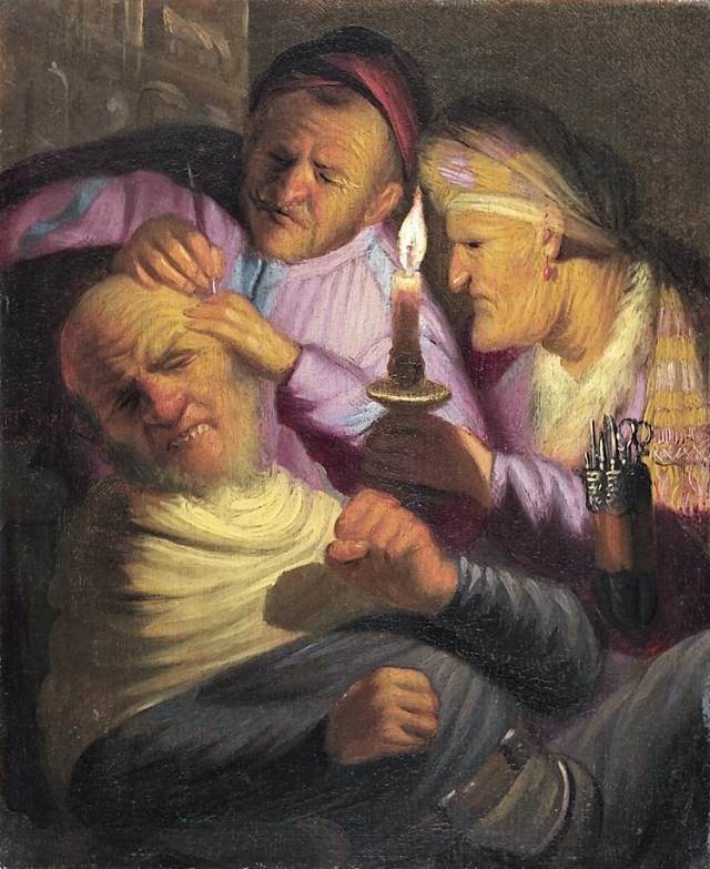 rembrandt-stone-operation